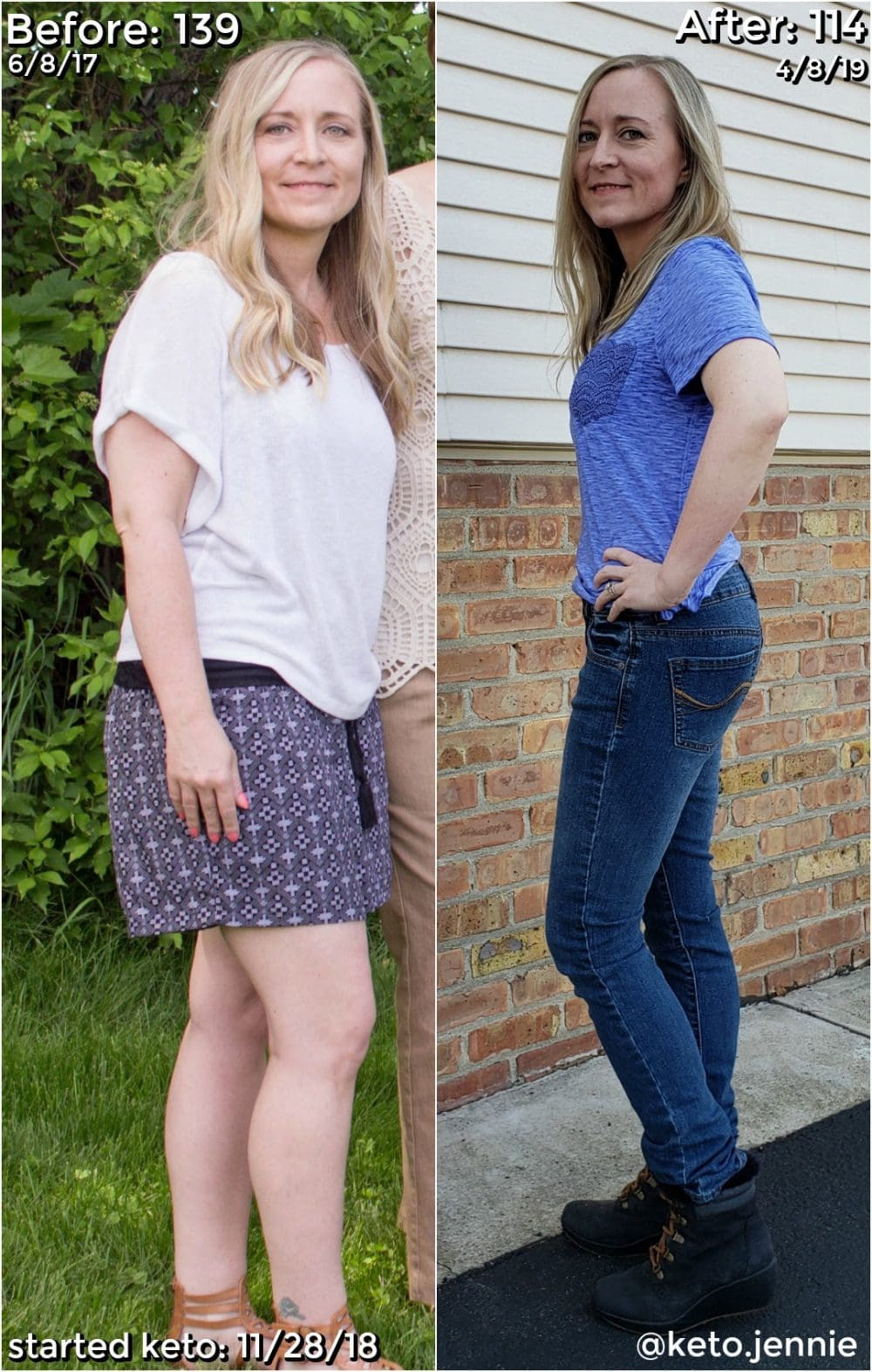 Keto Diet Before And After Pics
 My Personal Experience with the Keto Diet
