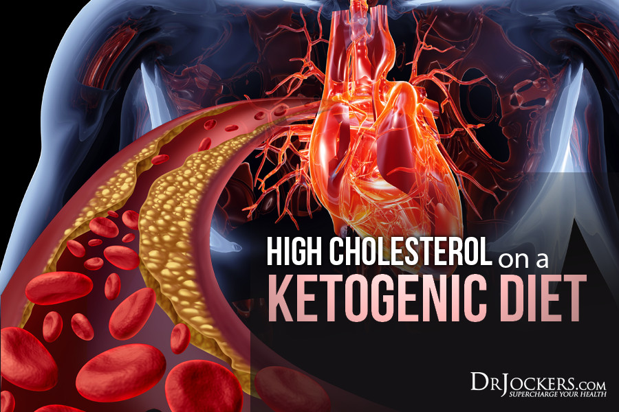 Keto Diet Cholesterol
 High Cholesterol on a Ketogenic t DrJockers